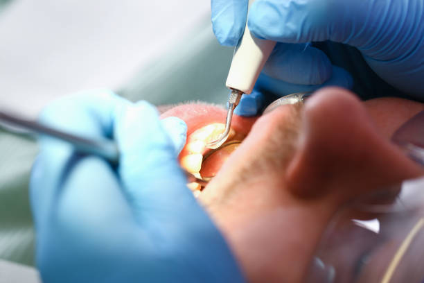 Best Knocked-Out Tooth Emergency  in Troy, TN