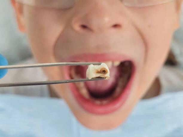 Best Broken Tooth Emergency  in Troy, TN